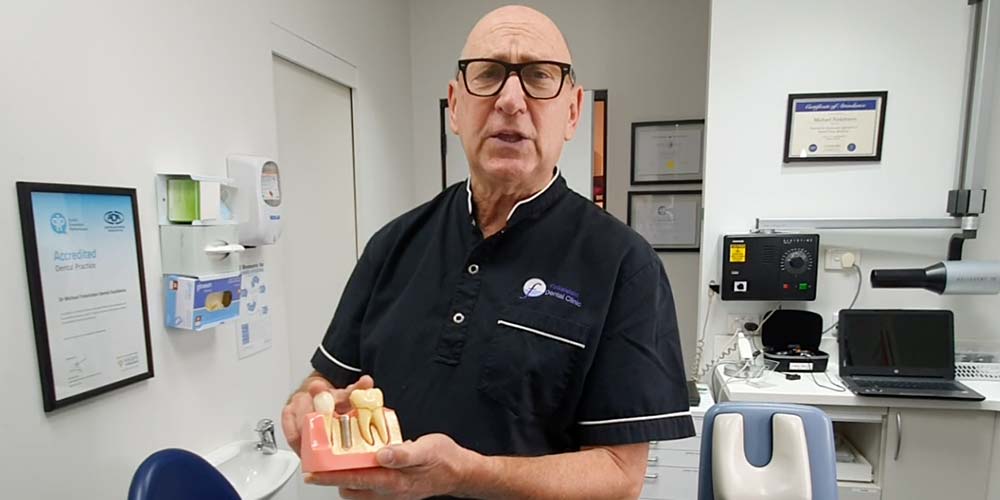 Dr Finkelstein showing Dental implants