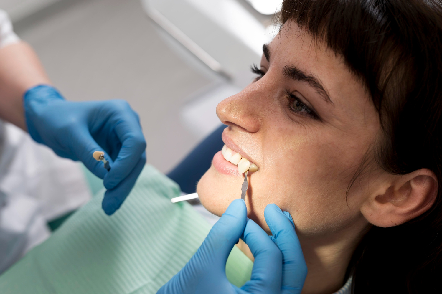 Composite Bonding