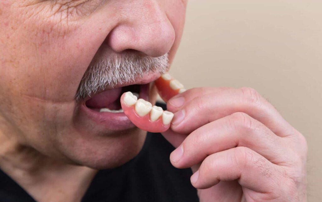 Man inserting a partial denture