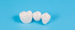Are Dental Crowns Permanent? Understanding Their Lifespan and Maintenance