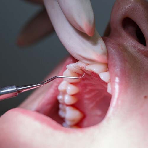 Dental examination