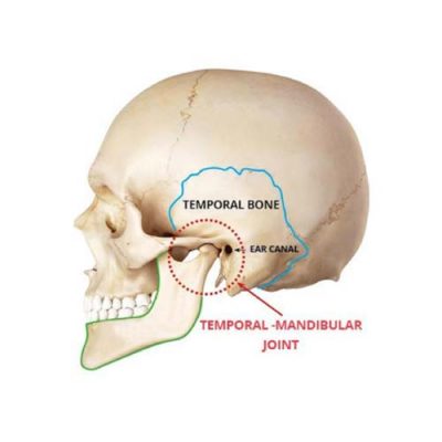 Tmj Dentist Treatment Sydney Dr Finkelstein Dentist Sydney