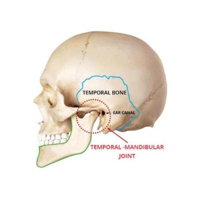 Temporal Mandibular Joint. shows the position of the joint where it connects with the ear canal and temporal bone