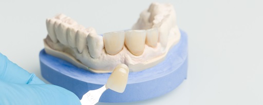 What Happens During a Dental Crown Procedure? A Step-by-Step Guide